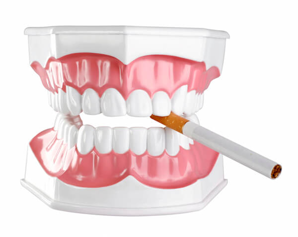 How Smoking Affects Periodontal Health