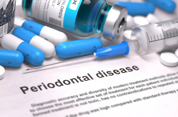 Periodontal Disease - Printed Diagnosis with Blue Pills, Injections and Syringe. Medical Concept with Selective Focus.