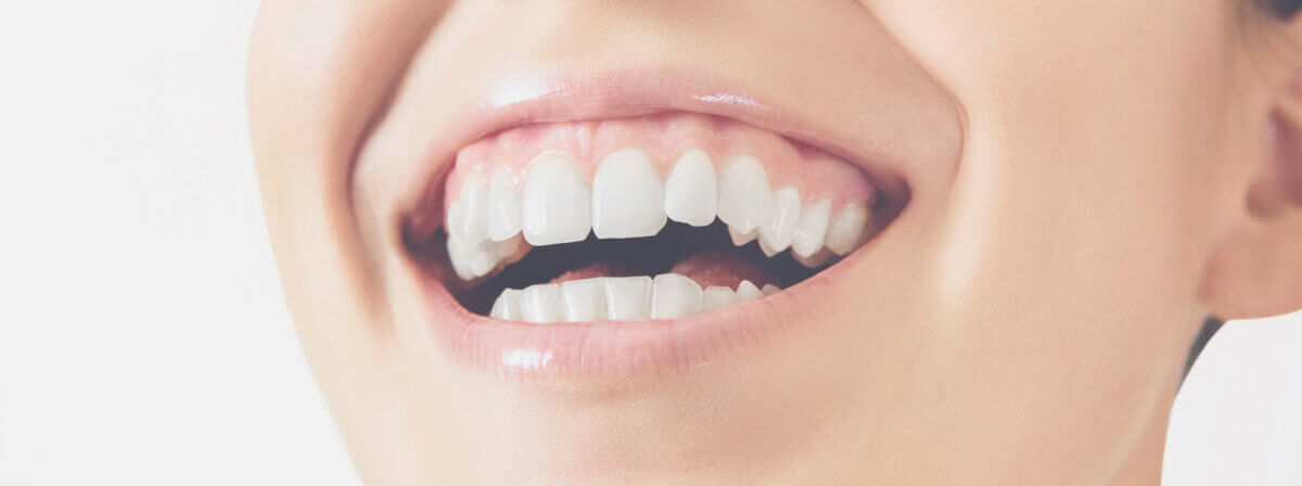 Woman smiling with gums showing, case of gummy smile. 