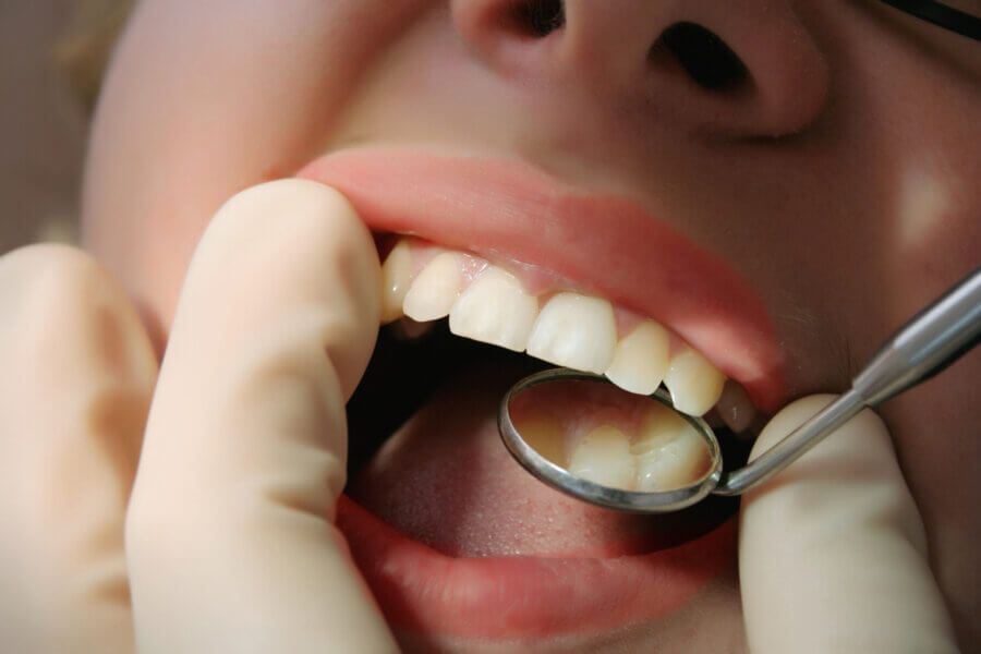 periodontal disease
teeth 
gums